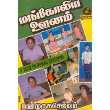 மங்கோலிய ஊனம்